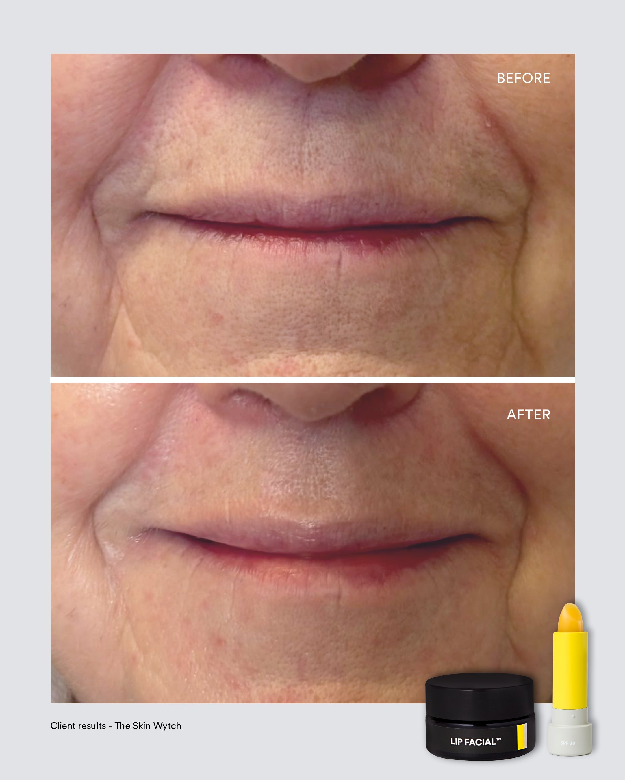 Plump & Protect Essentials Set